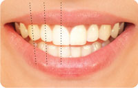 البعد النسبي ونسبة حجوم الأسنان وتطبيق القاعدة الذهبية على أطوال الأسنان